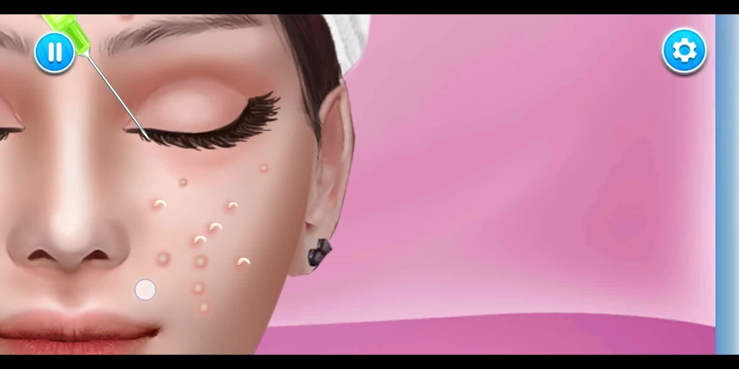 Acne treatment 👧🏻 through animation