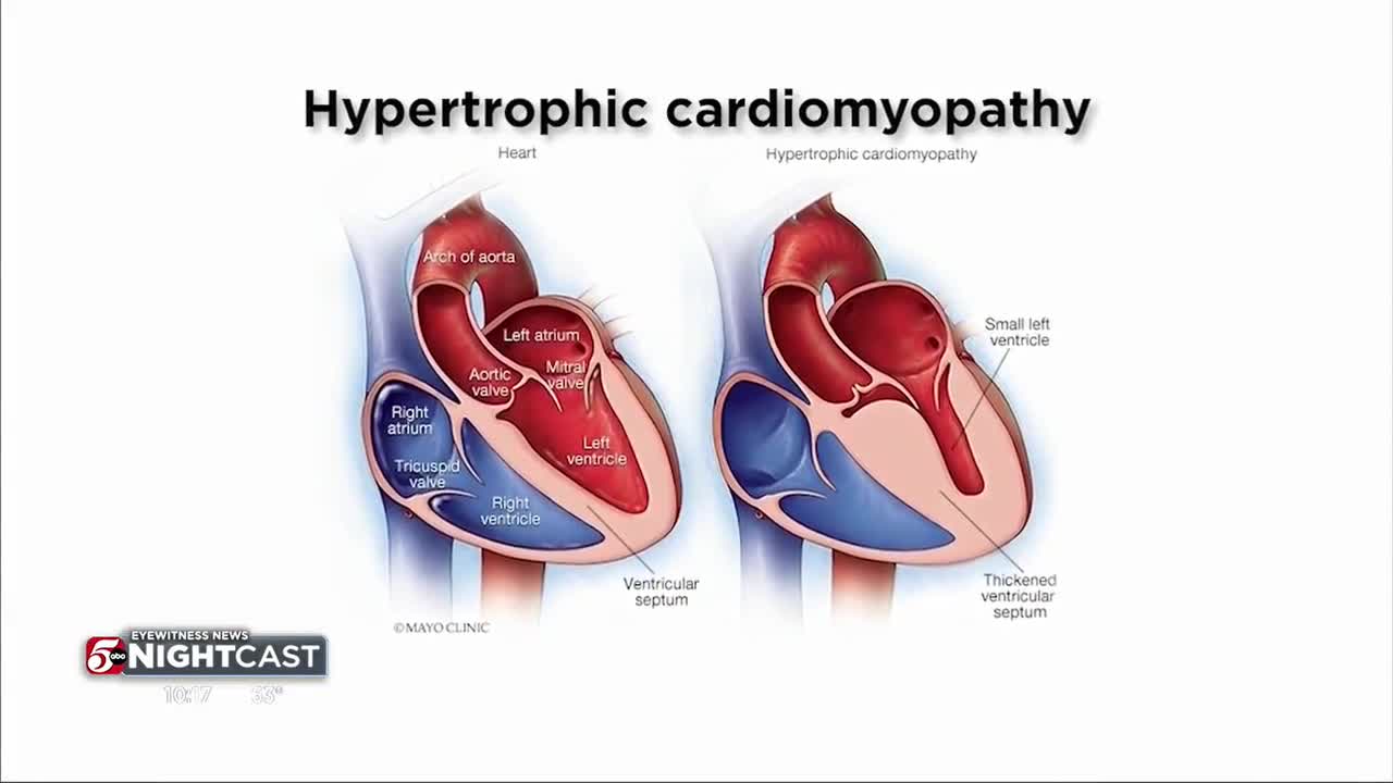 18 Year Old Died Suddenly From Cardiac Arrest, Dr. Said His Heart Was Fine 3 Months Earlier