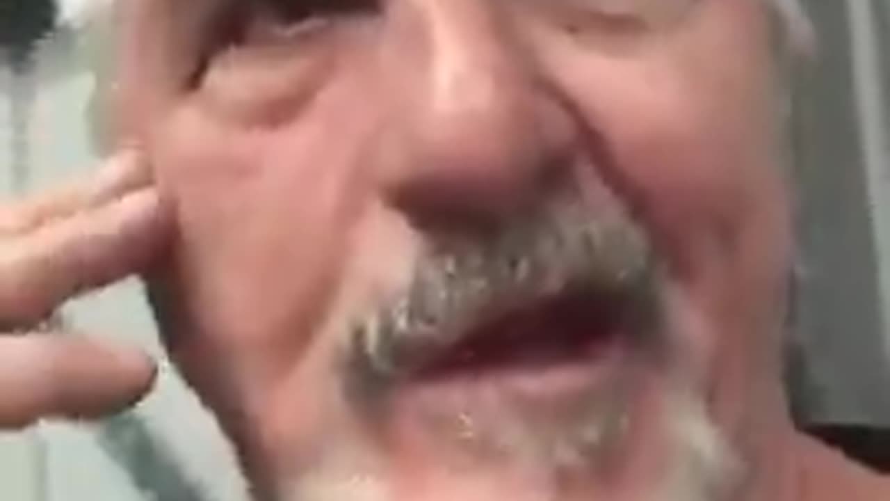 MAN GETS VACCINATED VIA BLOOD TRANSFUSION - HAS BELLS PALSY AND OTHER SYMPTOMS OF BEING VAXXED