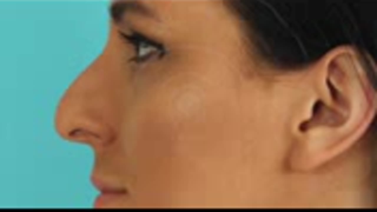 ⚡️GET A NATURAL RHINOPLASTY FAST- FIX YOUR NOSE NATURALLY- SUBLIMINAL AFFIRMATIONS FREQUENCY