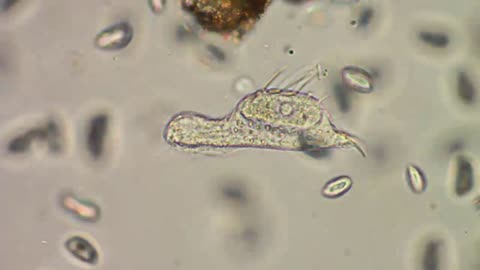 Chaetonotus Gastrotricha