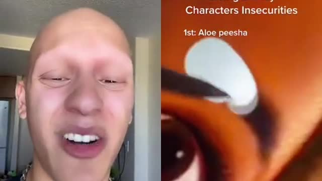 Alopecia is eggceptional