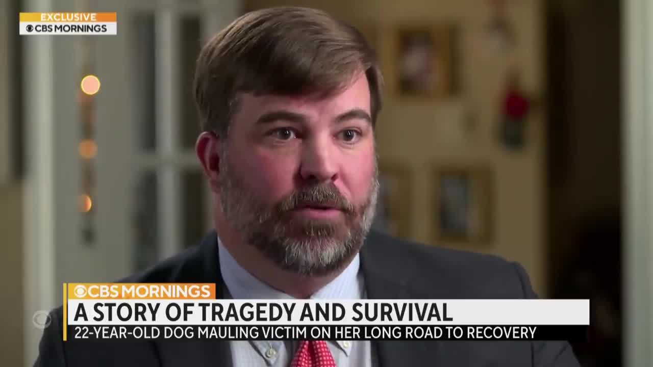 "It's time to show who I am now": Dog sitter recovering after losing face in horrific dog attack