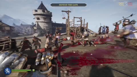 "Oh look you lost your arms and you died” 🌝