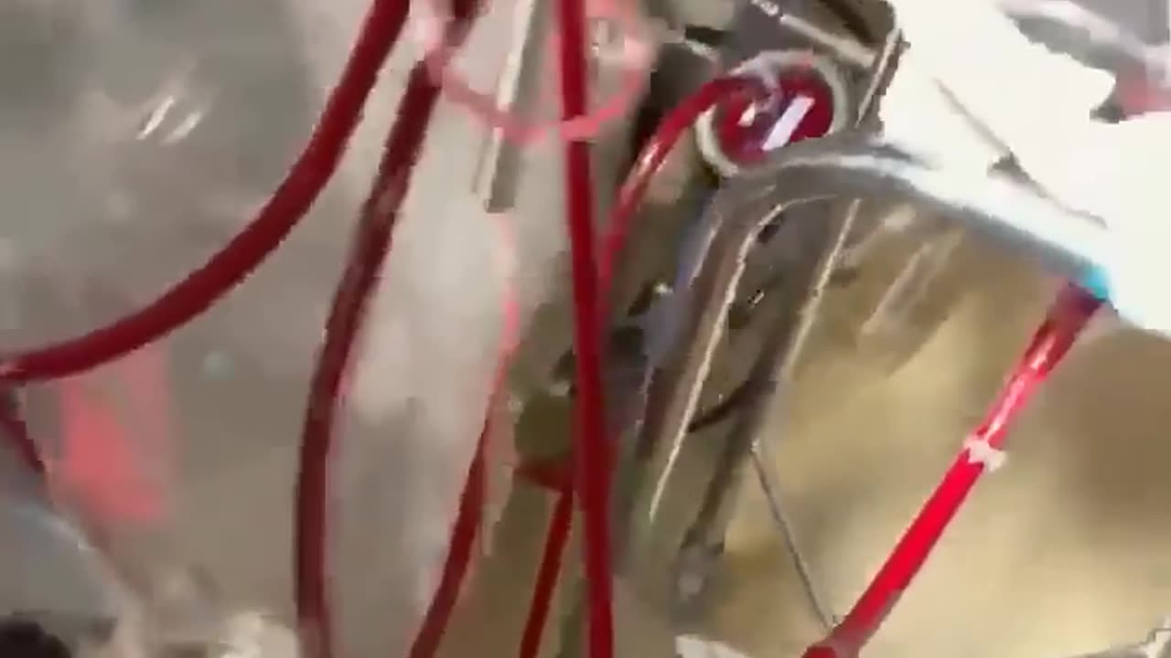 Open Heart Surgery
