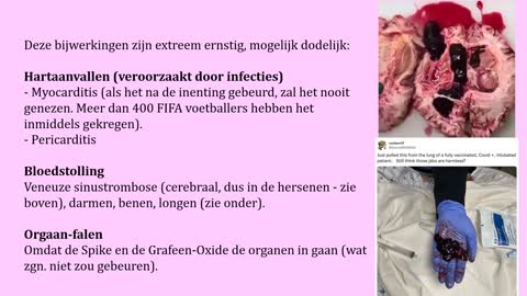 De Covid-19 False Flag & het levensgevaarlijke Nep-Vaccin