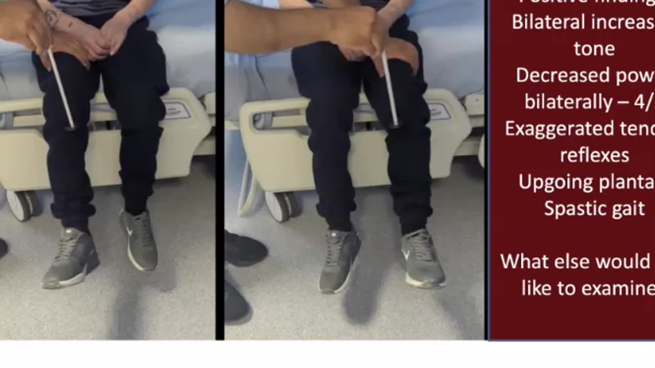 ST3.Examine the lower limbs of this man with recurrent fall