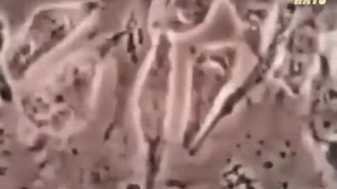Flouride Killing Cells
