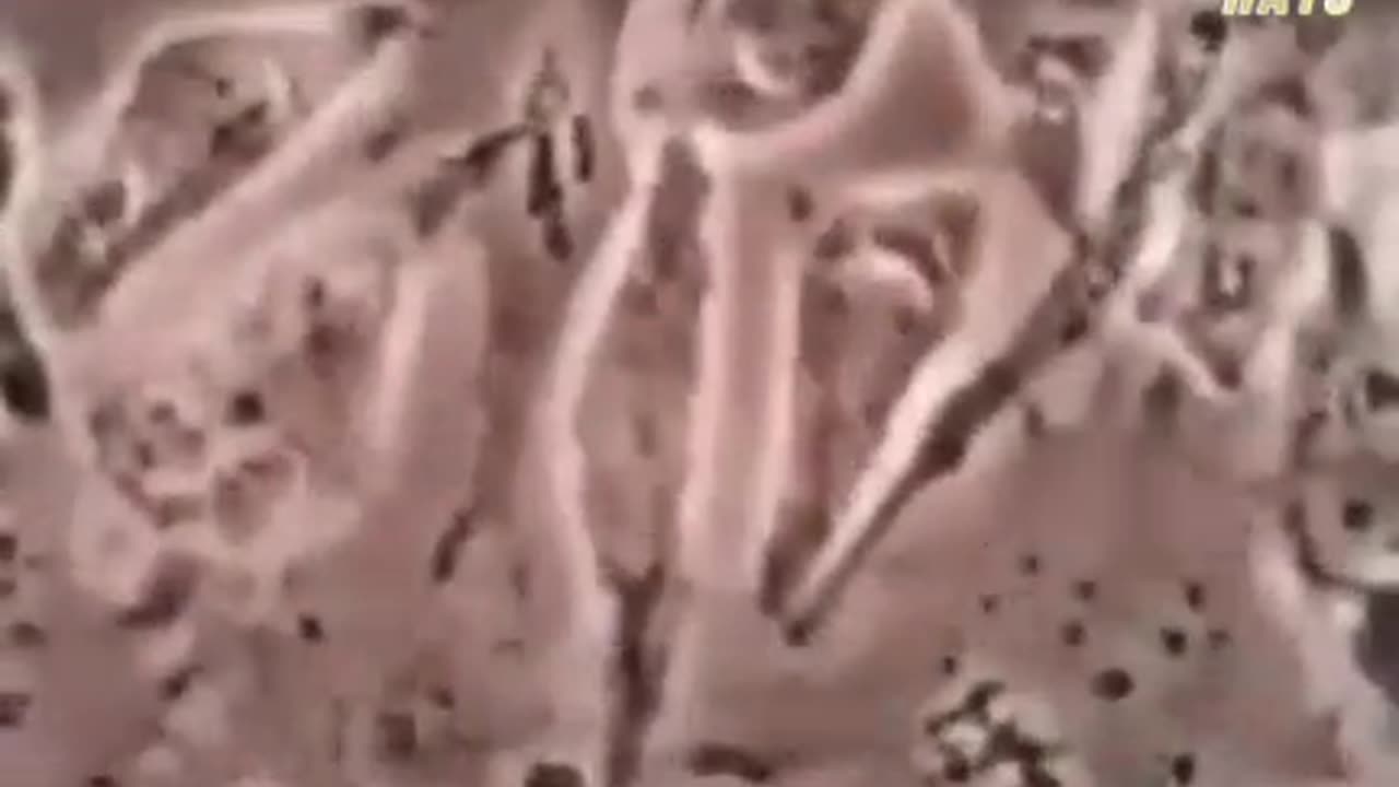 Flouride Killing Cells