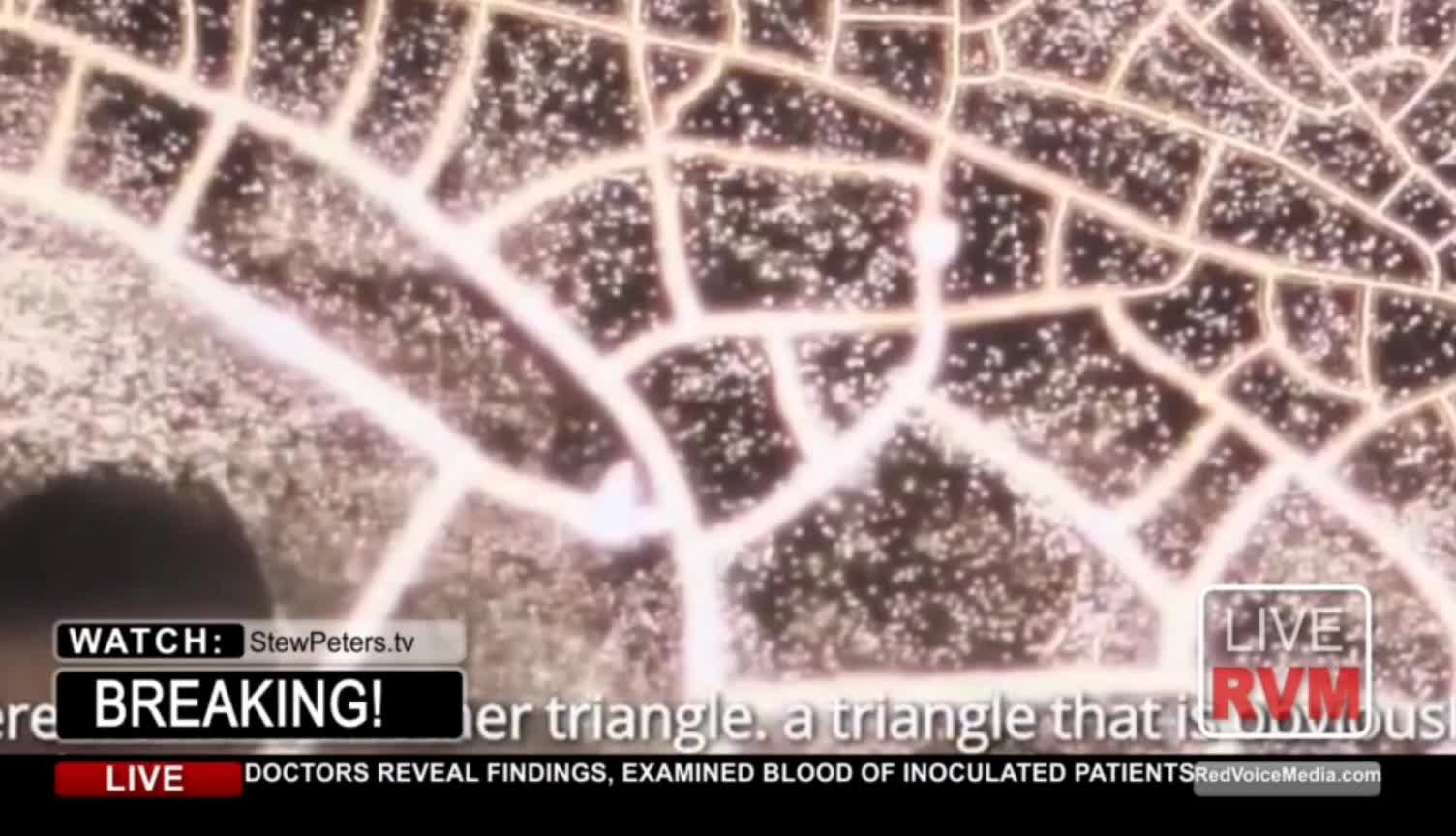 THE BLOOD OF MANY VACCINATED PATIENTS