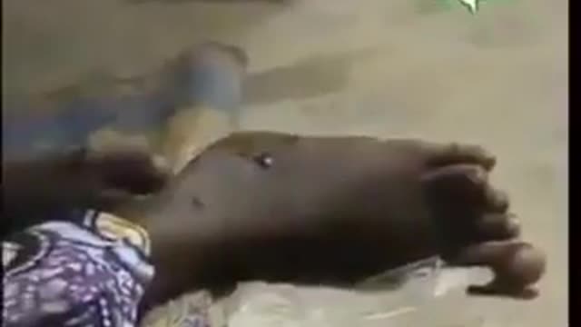 Quando la Pfizer sperimentò sui bambini africani