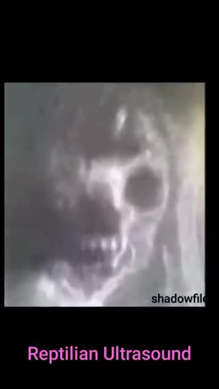 ~REPTILIAN ULTRASOUND ~