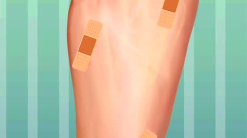 Injury legs treatment😷😷😷