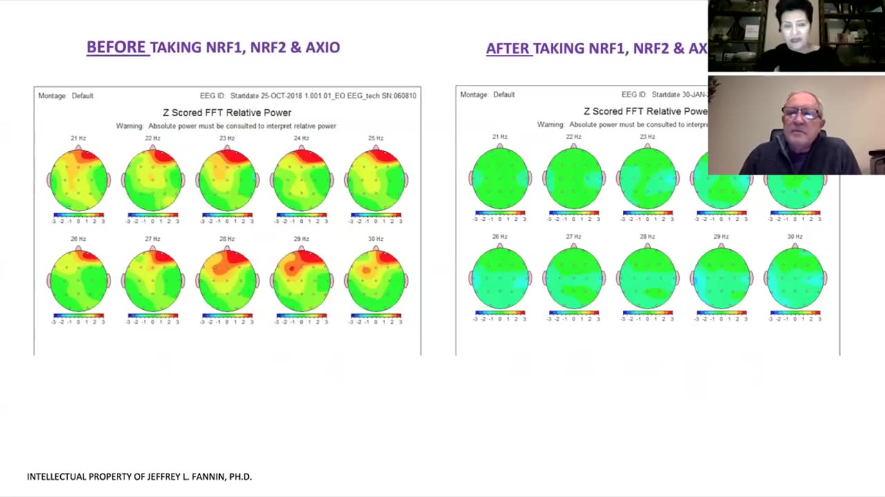 Brain Mapping shows benefits of Activation for the Brain