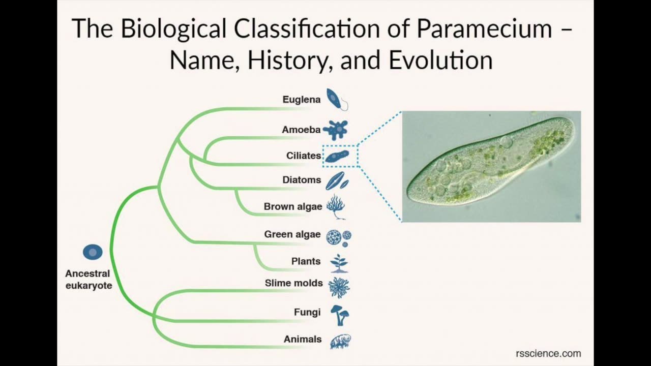 Paramecium Caudatum Under the Microscope