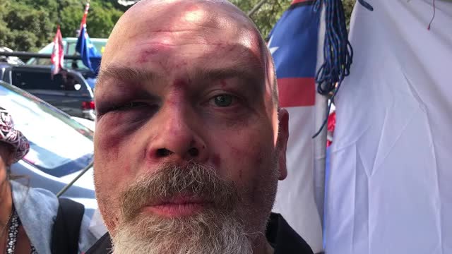 New Zealand senior sergeant punches and gouges eyes of freedom protester