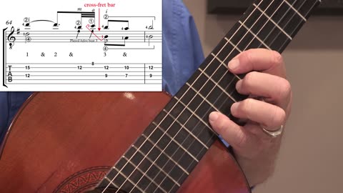 Technique Left-Hand, Part 2 (slow section). Video 11: m64, Version 4, cross-string ornament