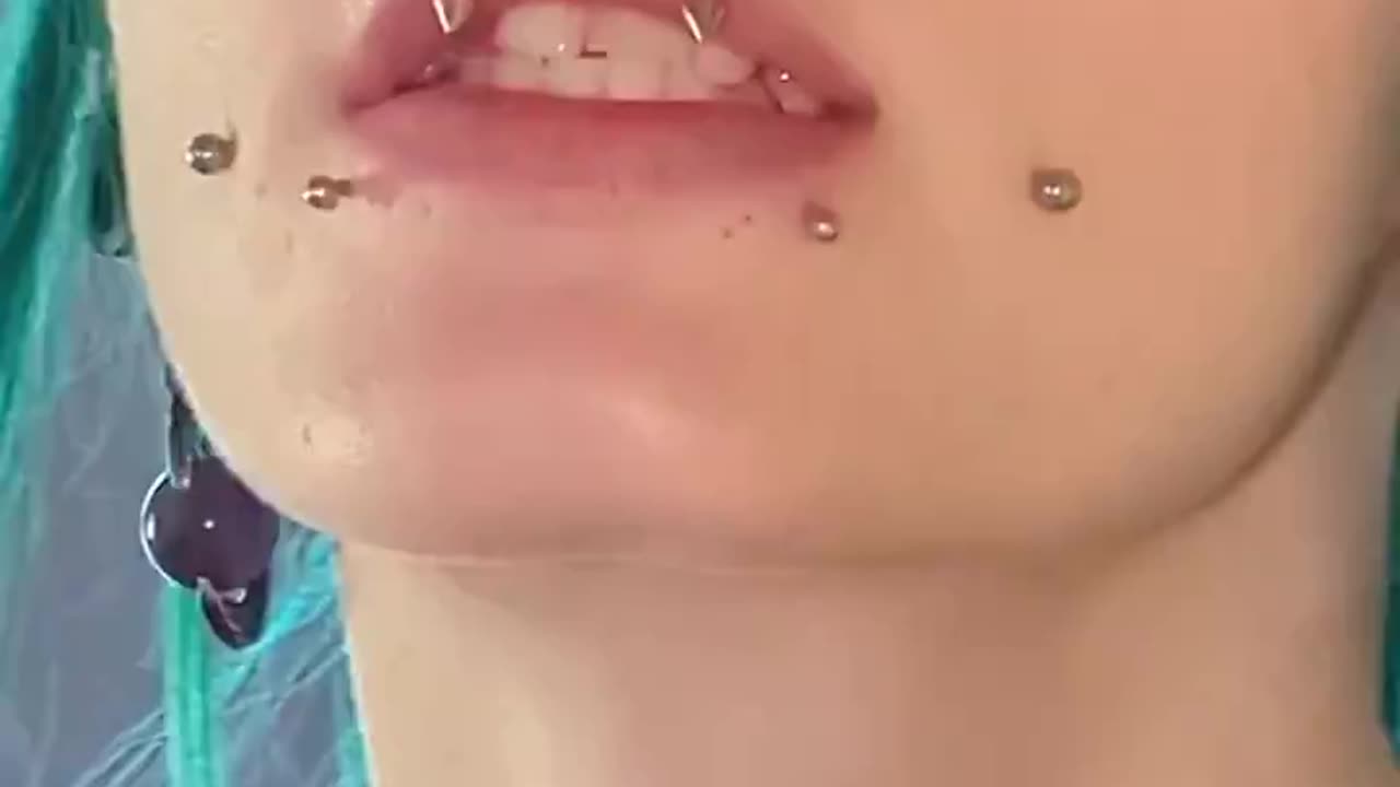 Pierced Eyeball