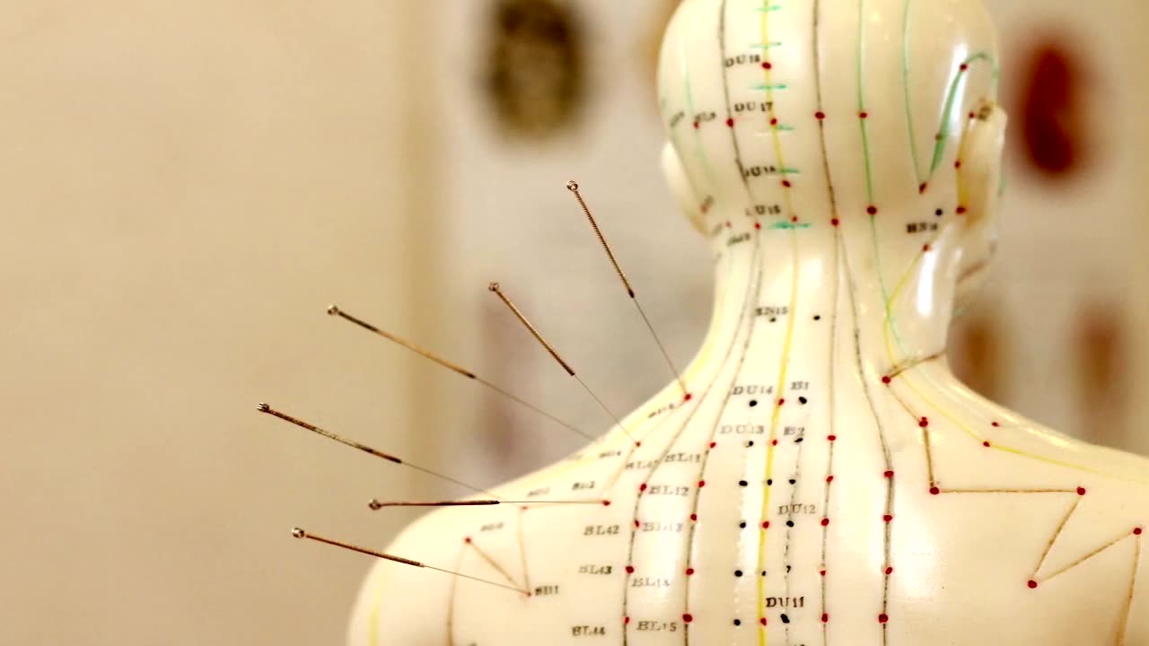 Acupuncture and the Meridian System