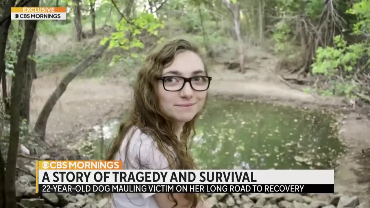 "It's time to show who I am now": Dog sitter recovering after losing face in horrific dog attack