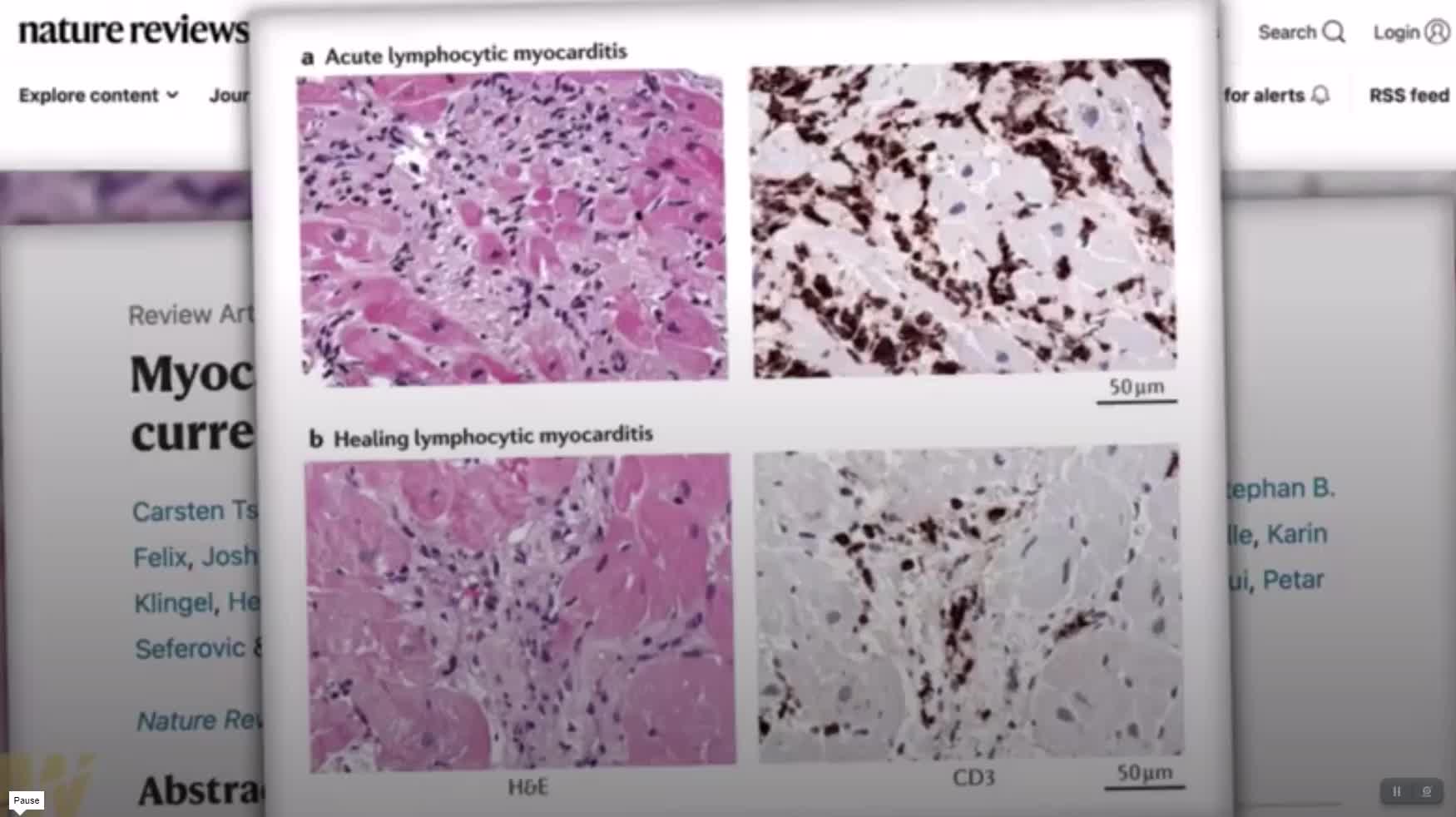 Dr. Ryan Cole on Child Heart Damage by Vaccine