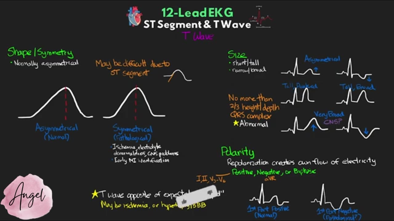 12-Lead Ekg Interpretation ST Segment & T Wave