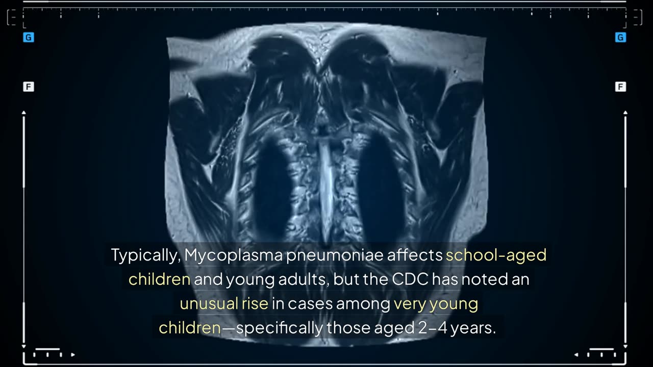 Mycoplasma Pneumoniae: Why Rising Infections Have the CDC on High Alert