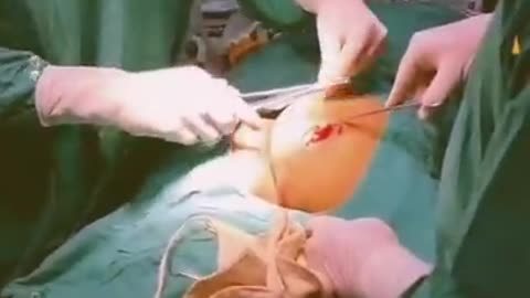 Doctor Such A Performing Surgery With New Method