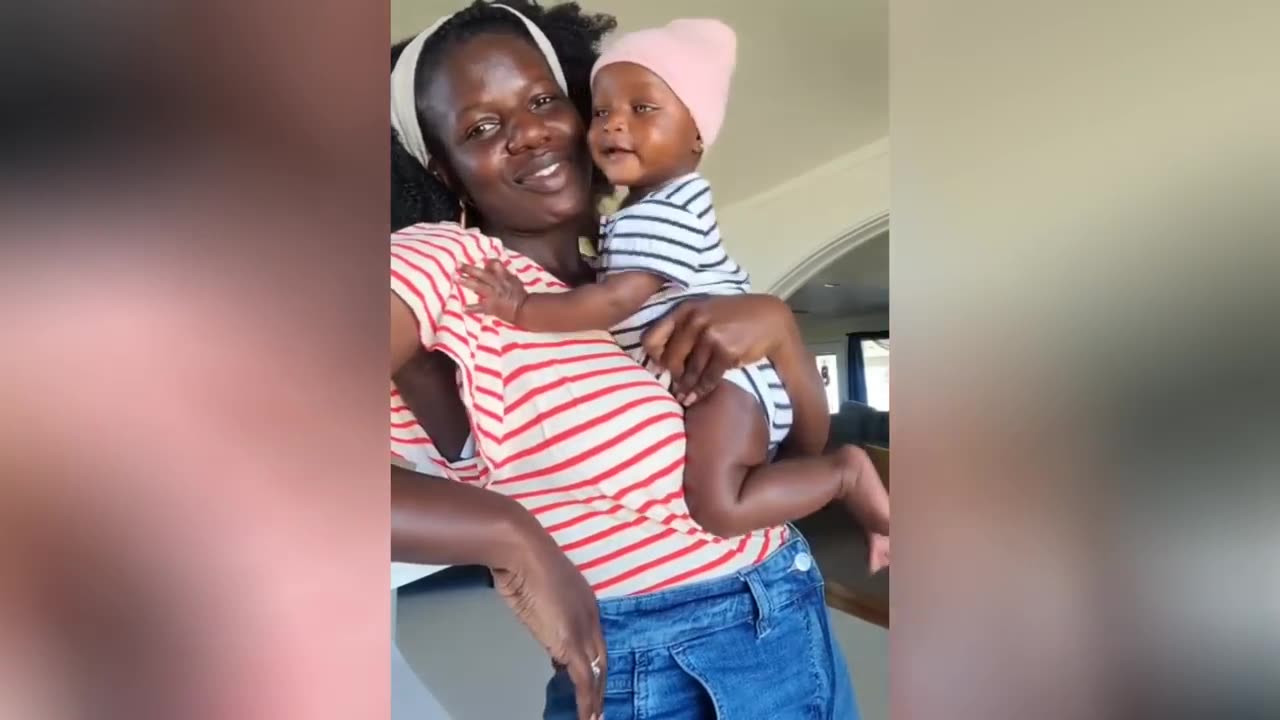 Unusual Babies That Surprised Even Their Parents