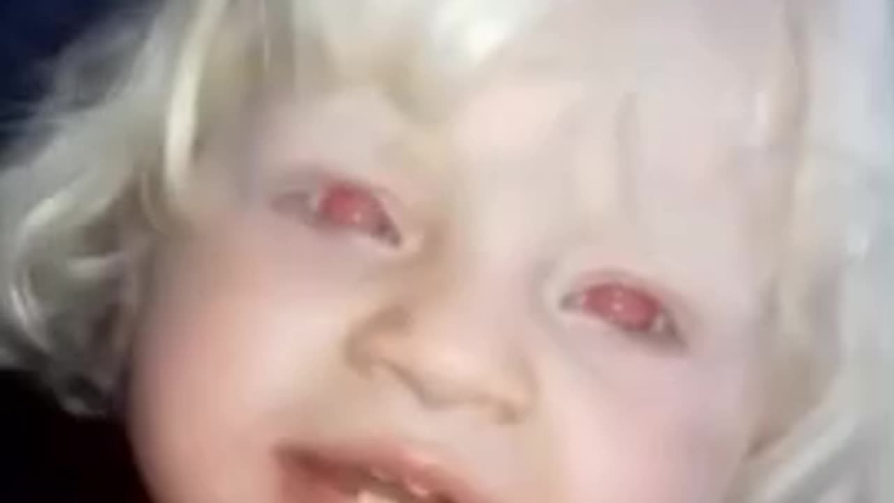 LITTLE GIRL WITH RED EYES ~THIS IS NOT A CAMERA DEFECT