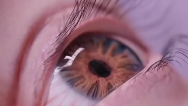 Spider in eye must see