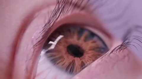 Spider in eye must see