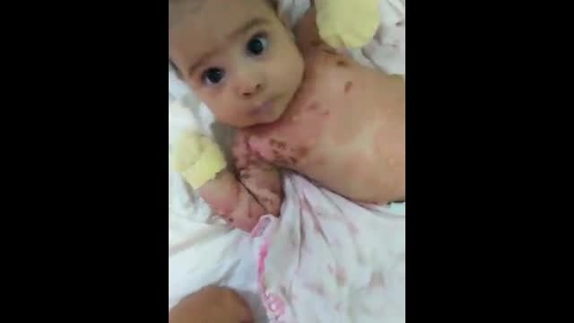 One Month Old Baby Of Vaccinated Mother