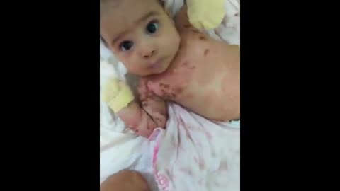 One Month Old Baby Of Vaccinated Mother