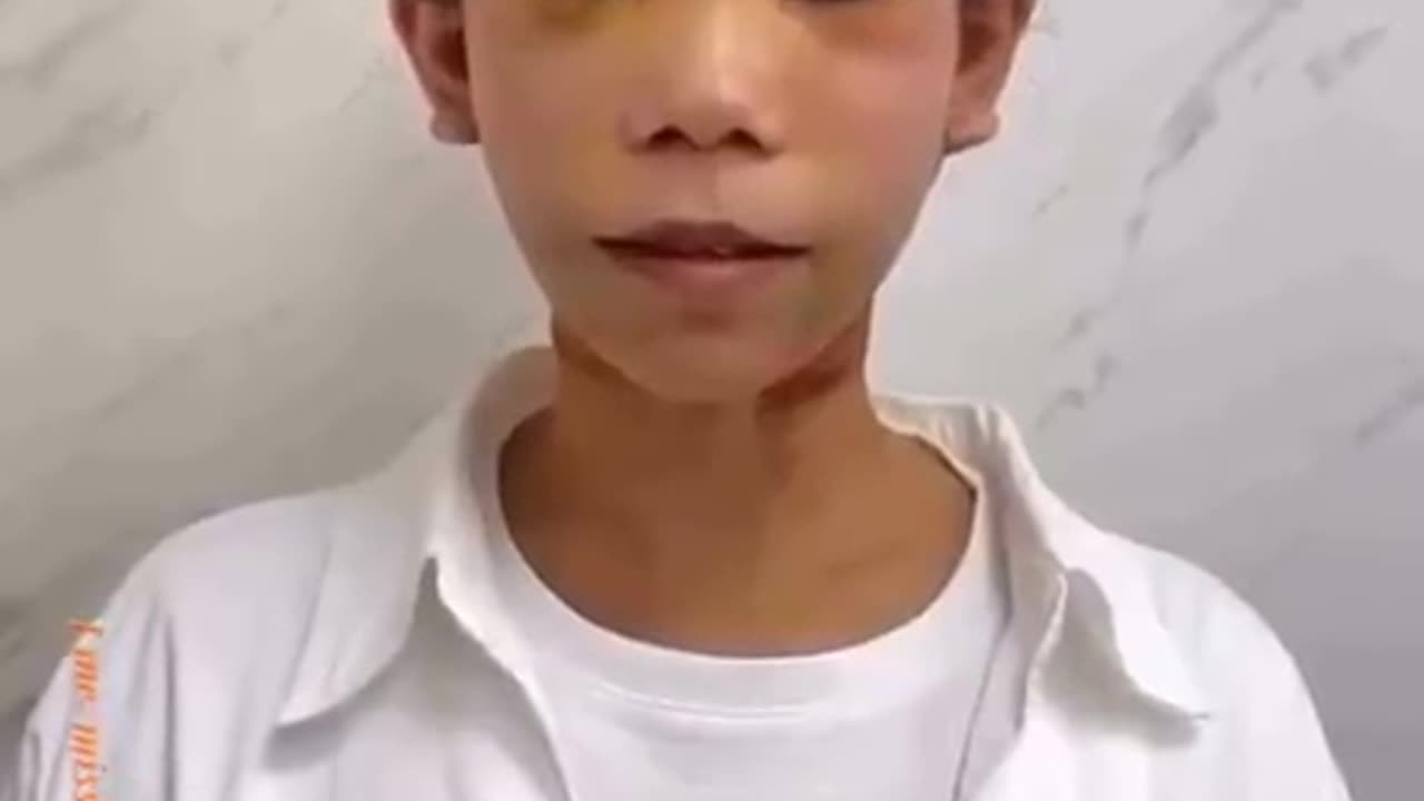 Face Transplants... Where are they getting the faces From?