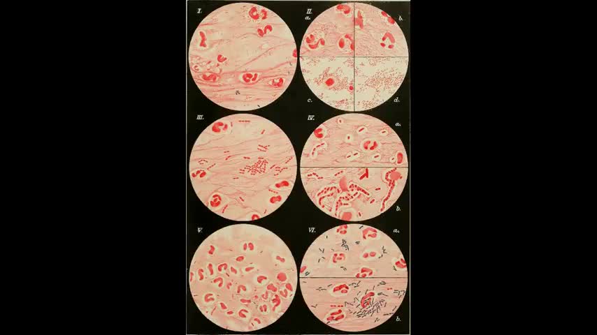 Bitchute Exclusive Video 33 Insulin Transgenics History