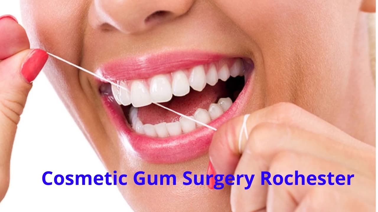 DENTAL IMPLANTS & PERIODONTAL HEALTH – Trusted Cosmetic Gum Surgery in Rochester