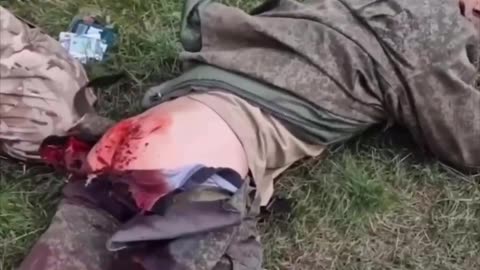 Russian Soldiers Being Treated by Ukrainian Medics