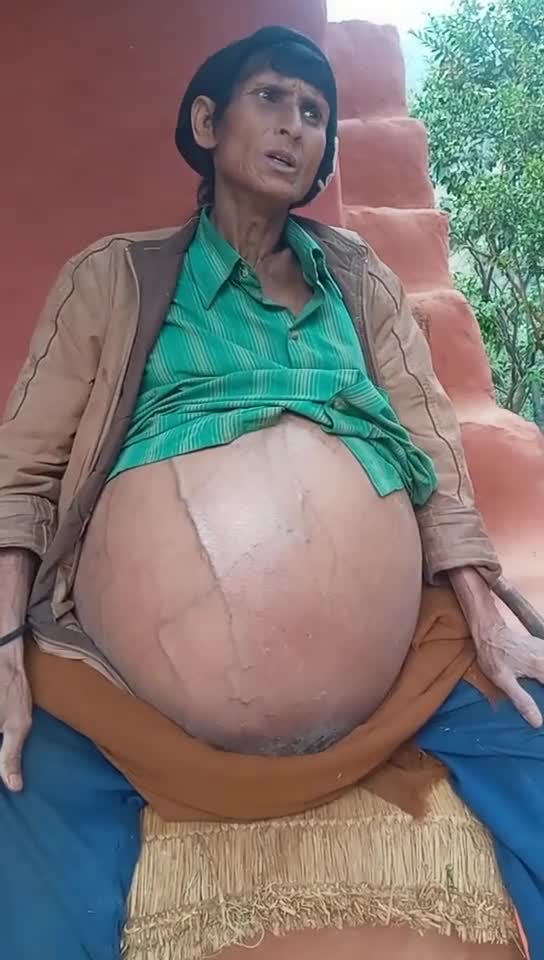 New deaseas found in body