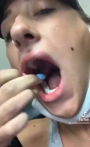 Busted Blood Vessels (Blood Clots) Around the Body After the Pfizer Shot