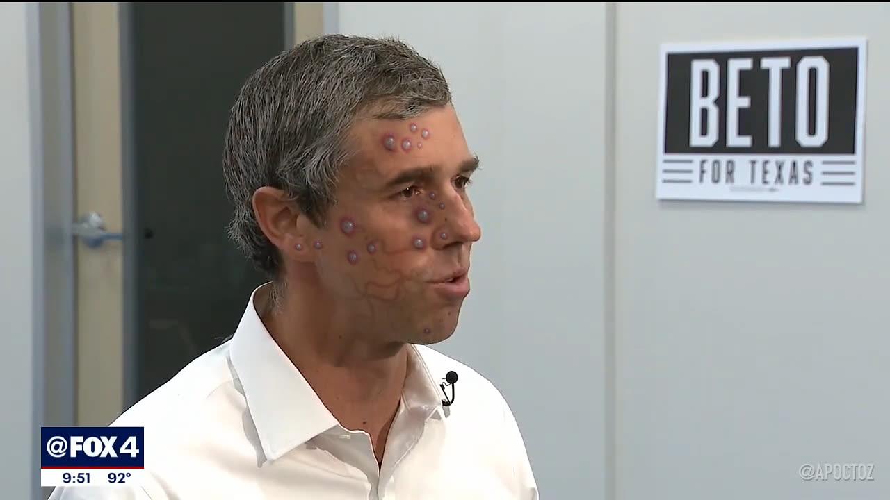 Beto Monkeypox