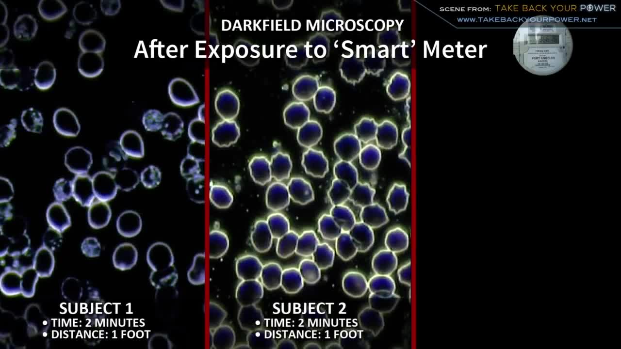 Smart Meter Health Effect