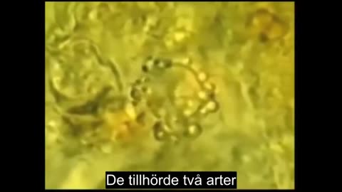 # 1158 - Cancer = Parasiter. SVENSKTEXTAD.