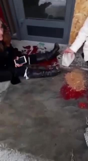 Ukraine War - Civilians Injured by Russians