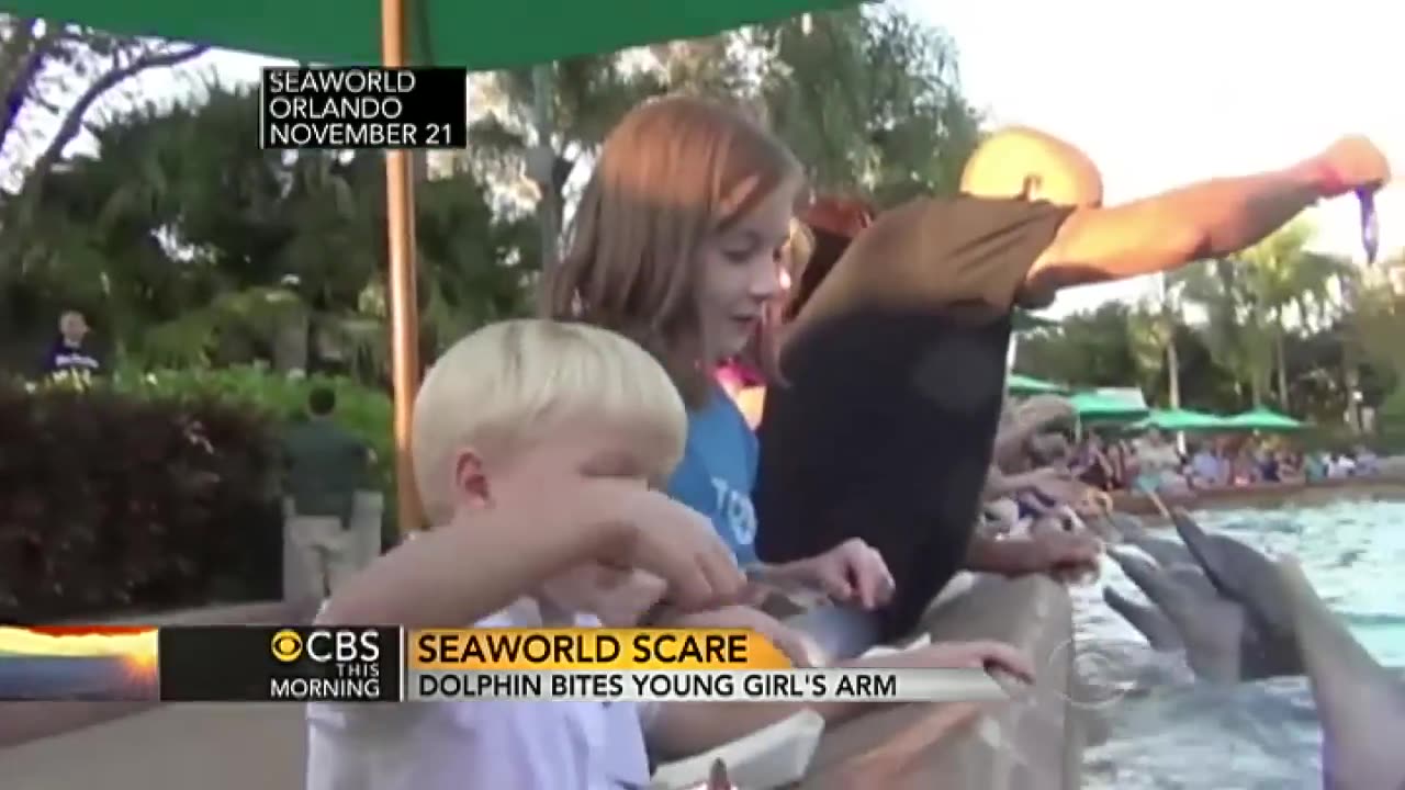 Dolphin bites hand of little girl, on tape