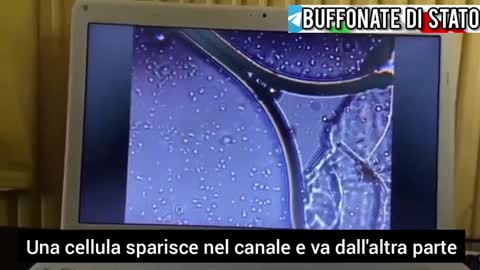 Le cinematografiche immagini di un 'vaccino' Pfizer al microscopio elettronico ingrandimento 2000x.