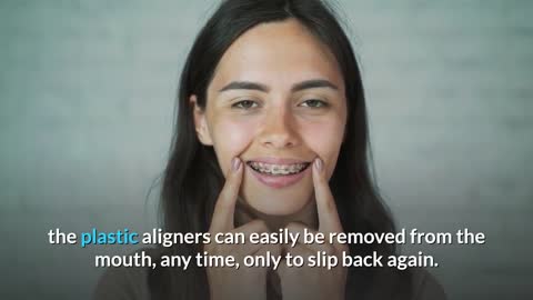 Easier And Faster Teeth Straightening With Invisalign Braces