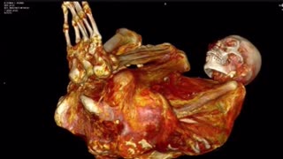 “Paloma” Nazca Mummy CT Scans