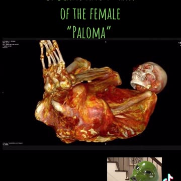 “Paloma” Nazca Mummy CT Scans