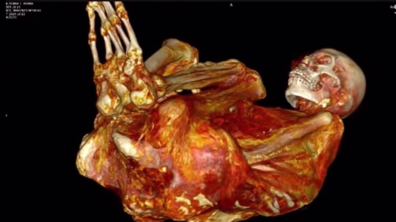 “Paloma” Nazca Mummy CT Scans